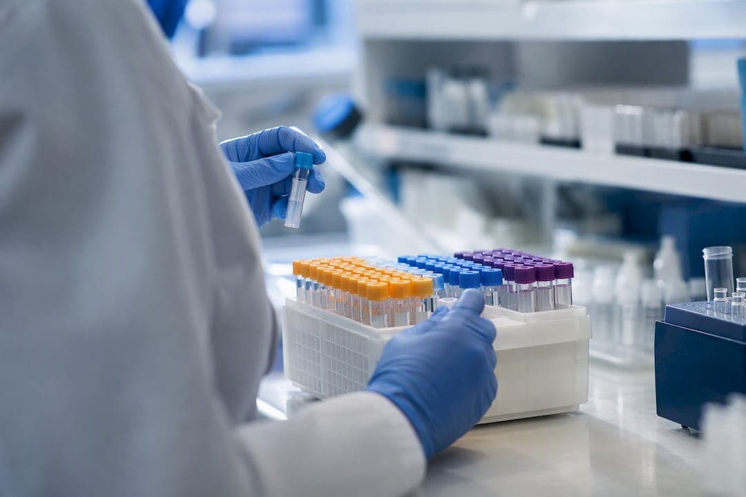 Sample Management: A Practical System for Modern Labs
